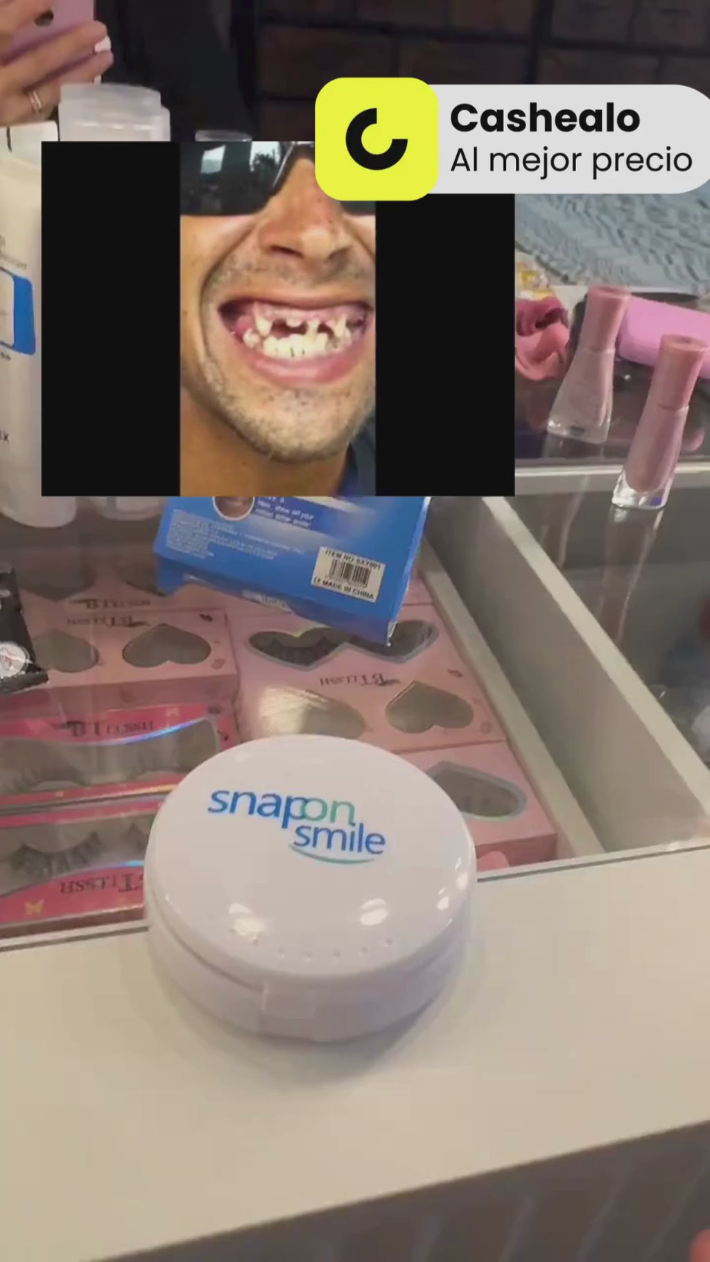 Carillas Dentales Snap on Smile (PAR)